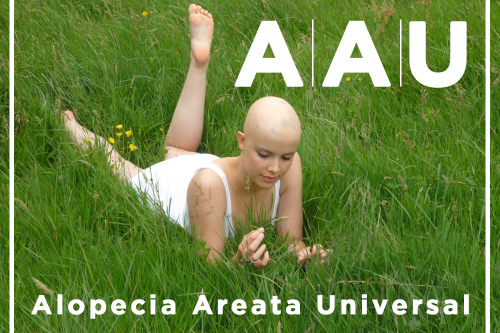 Alopecia Areata Universal | Estudios y tratamientos