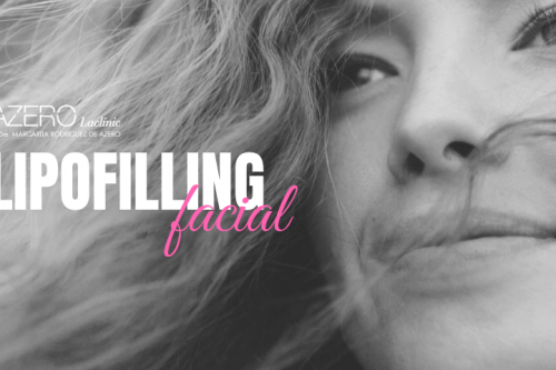 Lipofilling facial, rellenos de tu propio tejido natural