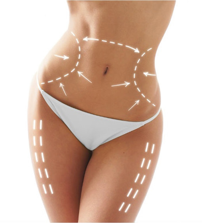 Lipofilling Corporal